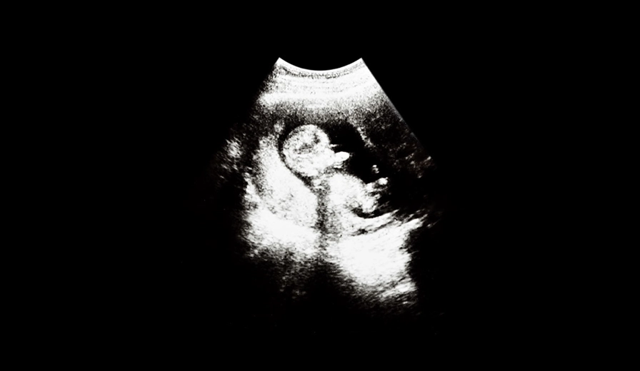 Smiths History 1958 Early Ultrasound Image